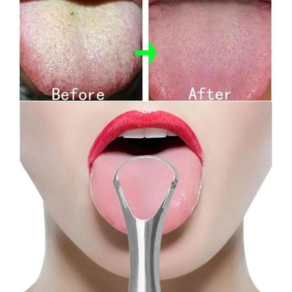 Stainless Steel Tongue Scraper — Reusable Portable Oral Cleaner | Fresh Breath & Hygiene Tool